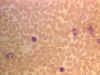 lympho-smear1.jpg (106241 bytes)