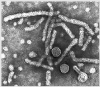 hbv3b.gif (47751 bytes)