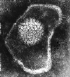 herpes.gif (48070 bytes)