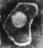 herpes.gif (48070 bytes)